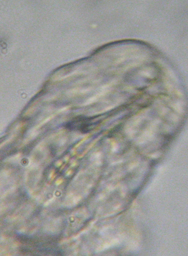 Tardigrado: probabile Macrobiotus richtersi